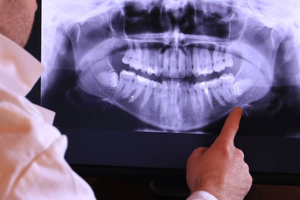 Best Emergency TMJ Treatment in Fayetteville, TN